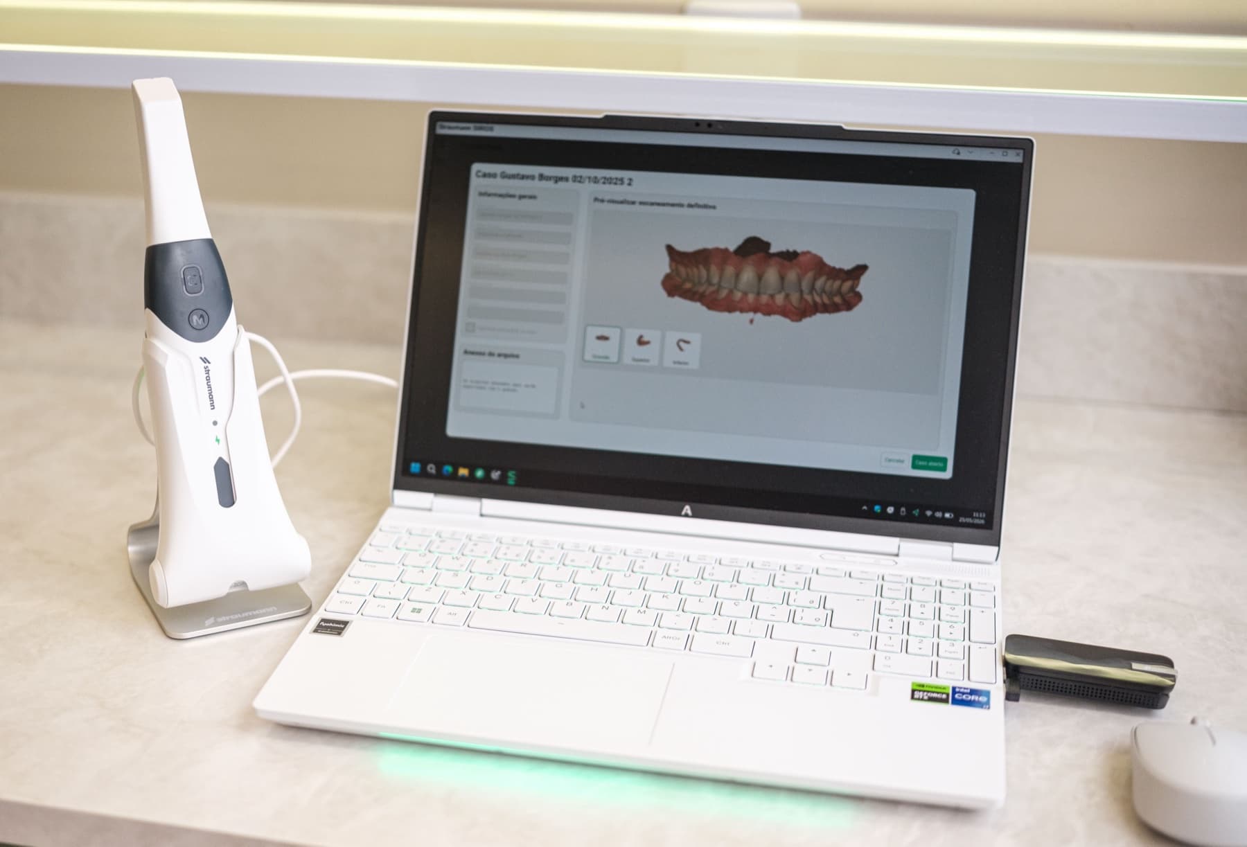 Scanner 3D Intraoral — Tecnologia de última geração